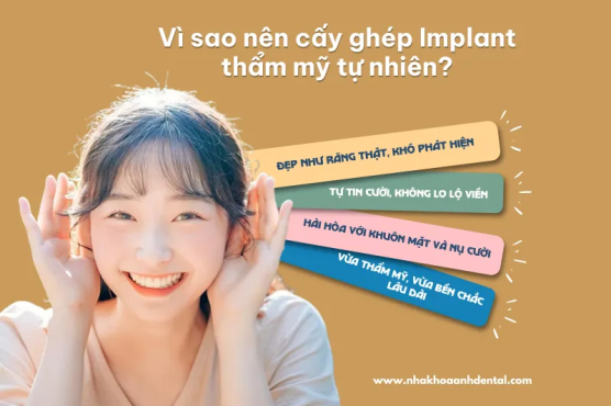 Implant thẩm mỹ tự nhiên - Giải pháp phục hồi răng đẹp như răng thật