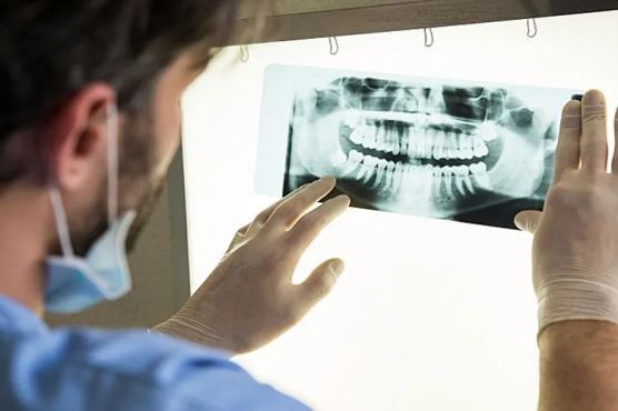 Khám CT răng là gì? Có cần thiết chụp CT khi đi khám răng không?