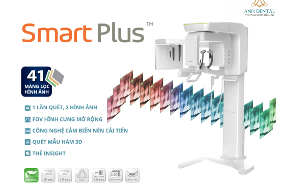 Khám phá máy CT Prod Smart Plus - Giải pháp chẩn đoán hình ảnh nhất