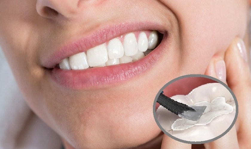 Bảng giá dịch vụ Nha khoa tổng quát tại Nha khoa Thanh Triều 2025