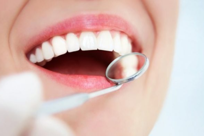 Bọc răng sứ là gì? Có bao nhiêu loại răng sứ? Giá cả như thế nào?